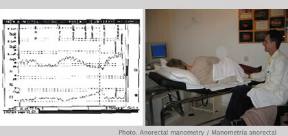 Manometría anorectal