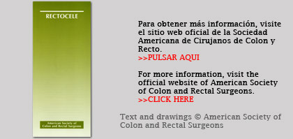 Rectocele